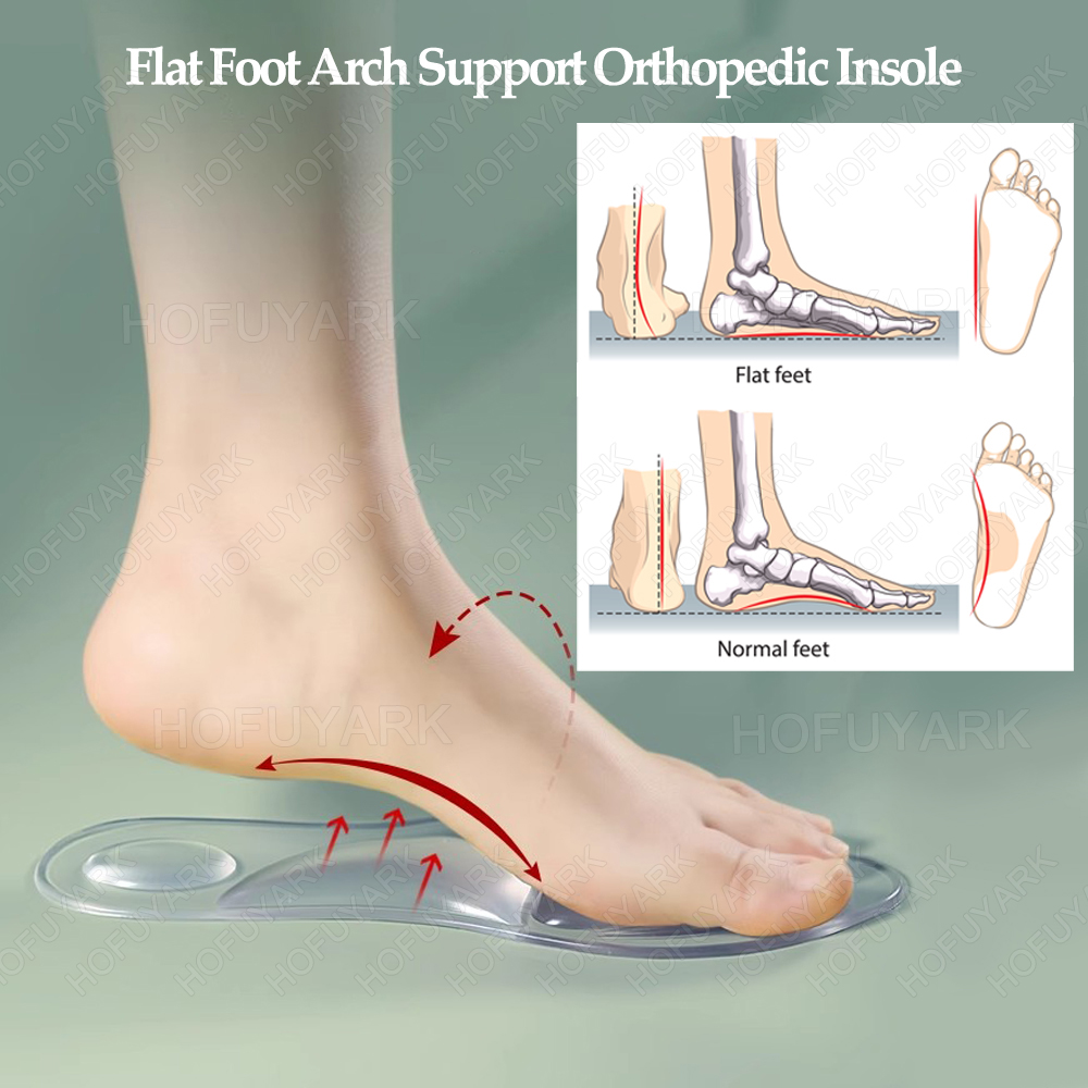 Solette in gel di silicone Sol - Women'S Shoes For Plantar Fasciitis recensione e prezzo